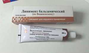 Использование мази вишневского при варикозе, тромбофлебите нижних конечностей