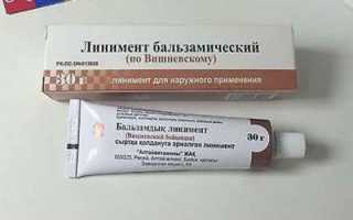 Использование мази вишневского при варикозе, тромбофлебите нижних конечностей