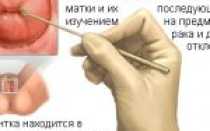 Смешанная флора в мазке – что это и о чем свидетельствует?