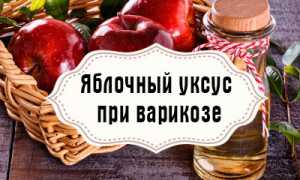 Яблочный уксус при варикозе ног – как пользоваться
