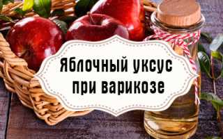 Яблочный уксус при варикозе ног – как пользоваться