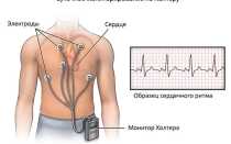 Циркадный индекс: что это такое, нормы и причины сниженного и повышенного показателя
