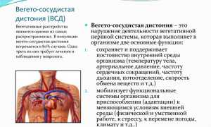 Вегето сосудистая дистония – лечение и препараты