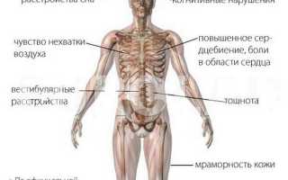 НДЦ – что это такое и с чем связано это заболевание. Дистония церебральных сосудов