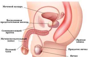Боль внизу живота у мужчин: локализация, причины, симптомы. Диагностика и варианты лечения
