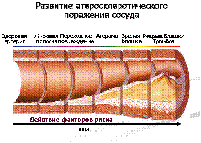 Корригировать содержание холестерина в крови