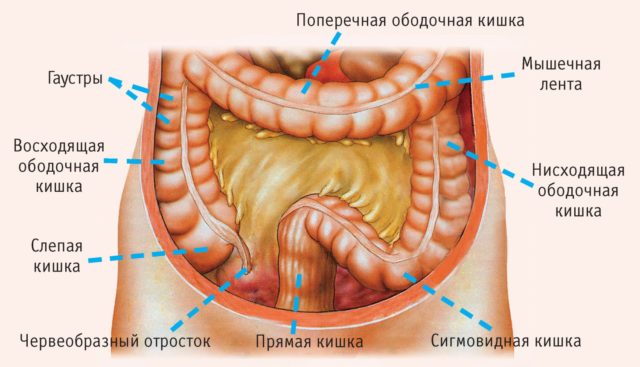 Тромбоз кишечника тт
