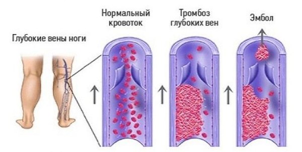 глубокие вены