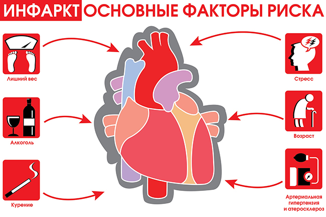 инфаркта миокарда,