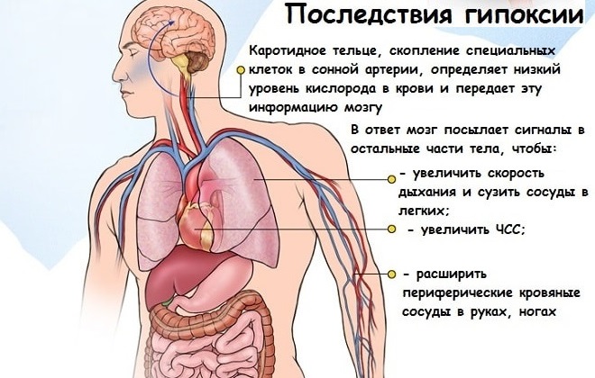  кислородного голодания
