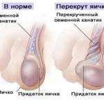 клиническая стадия заболевания