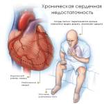 недостаточность сердечно-сосудистой
