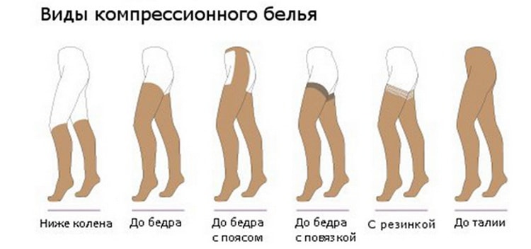 ношение компрессионного белья;