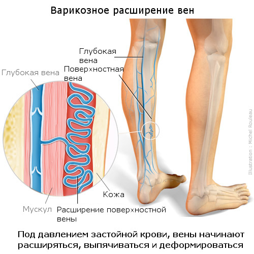 схему лечения