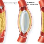 сосудистой ишемией
