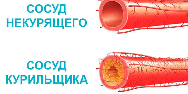 сосуды