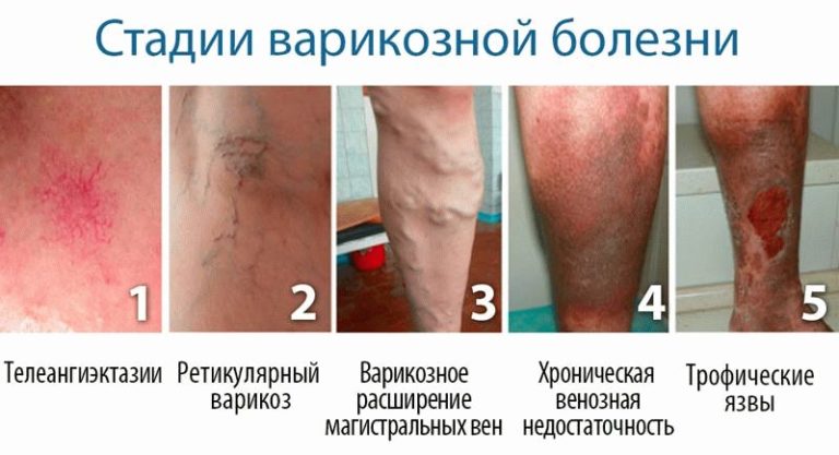 стадии