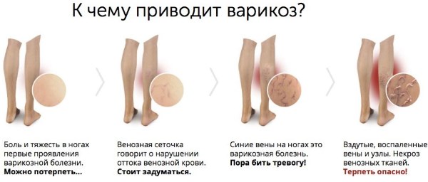 стадии