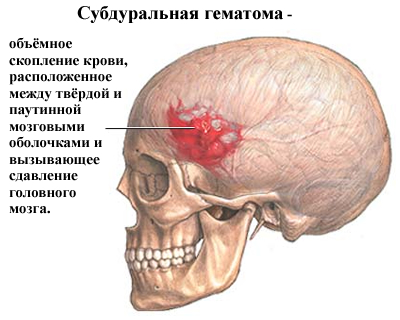 травматические поражения черепа