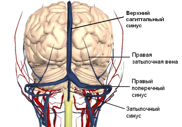 тромбоз венозного синуса