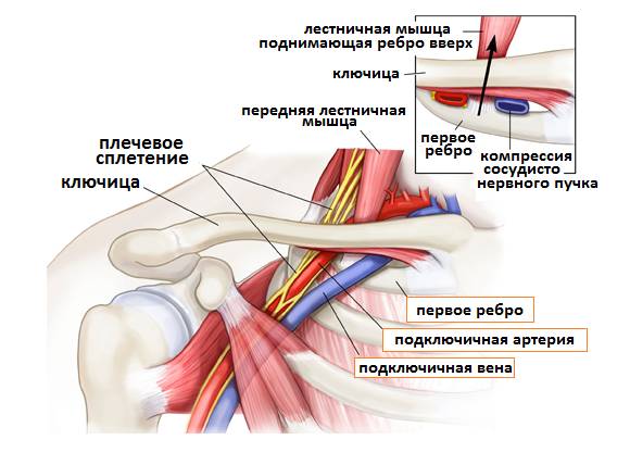 тромбозом внутренней яремной вены