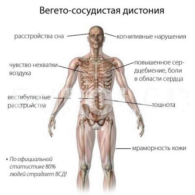 всд