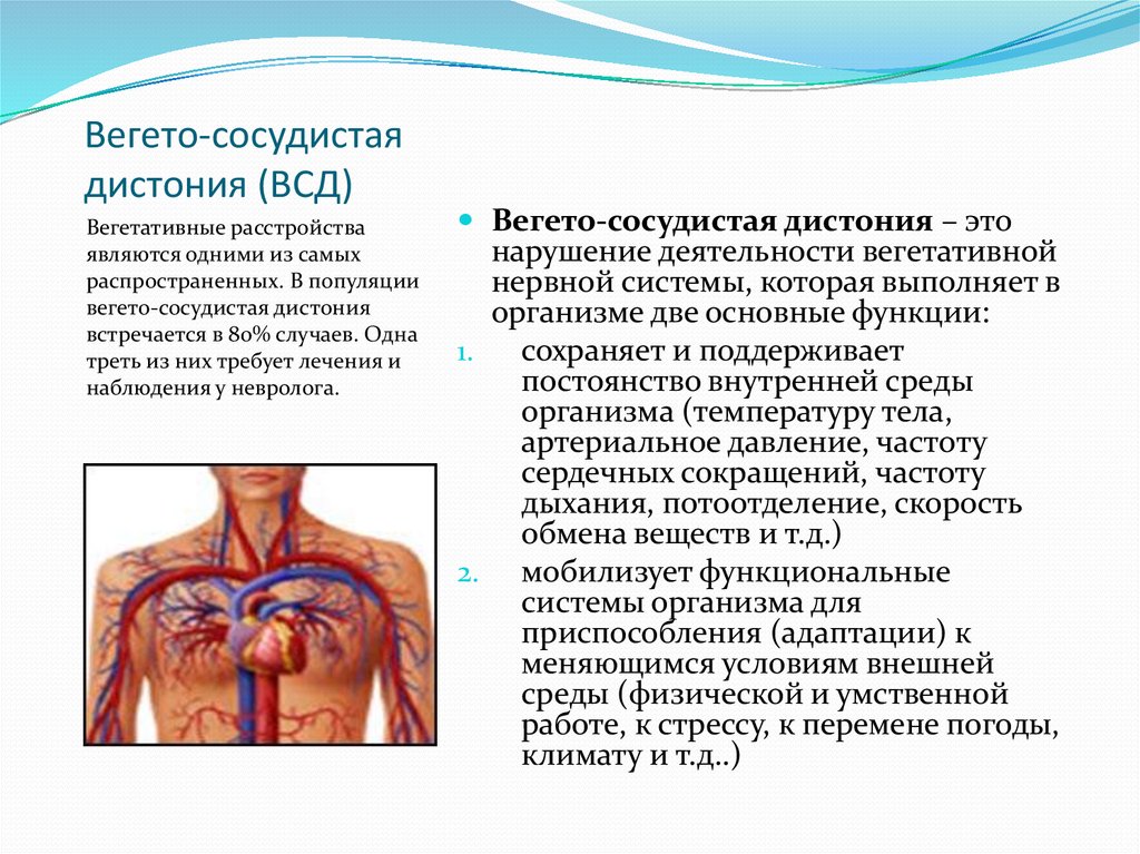 всд