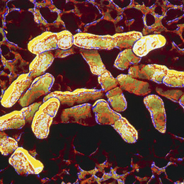 Gardnerella vaginalis Gardnerella vaginalis