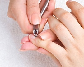 Заусенцы на пальцах. Лечение и причины возникновения Заусенцы на пальцах. Лечение и причины возникновения