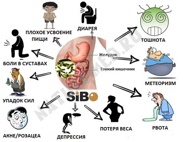 Чем грозит синдром дырявого кишечника? И грозит ли вообще