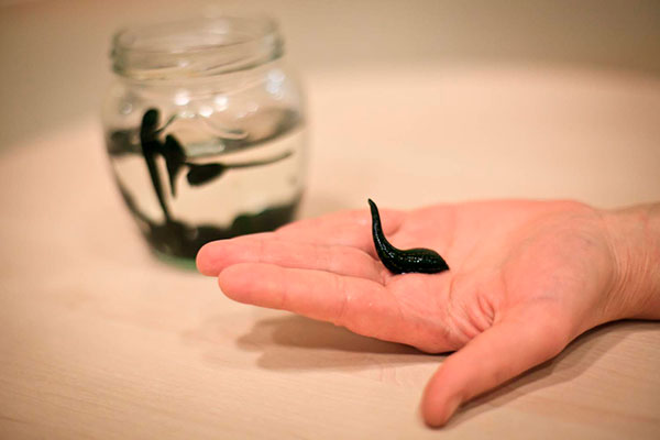 Лечения пиявками