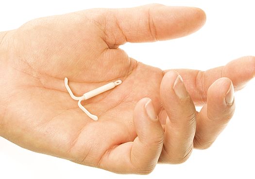 Спираль Мирена