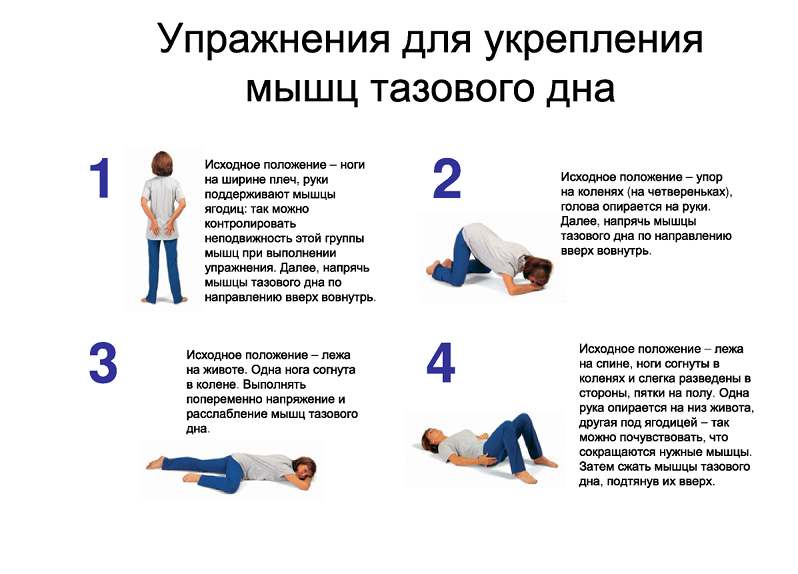 Укрепление мышц влагалища