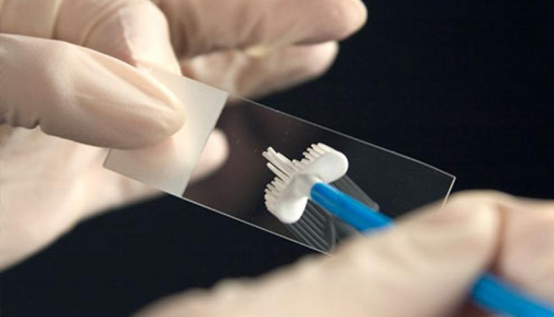 анализ на рак шейки матки