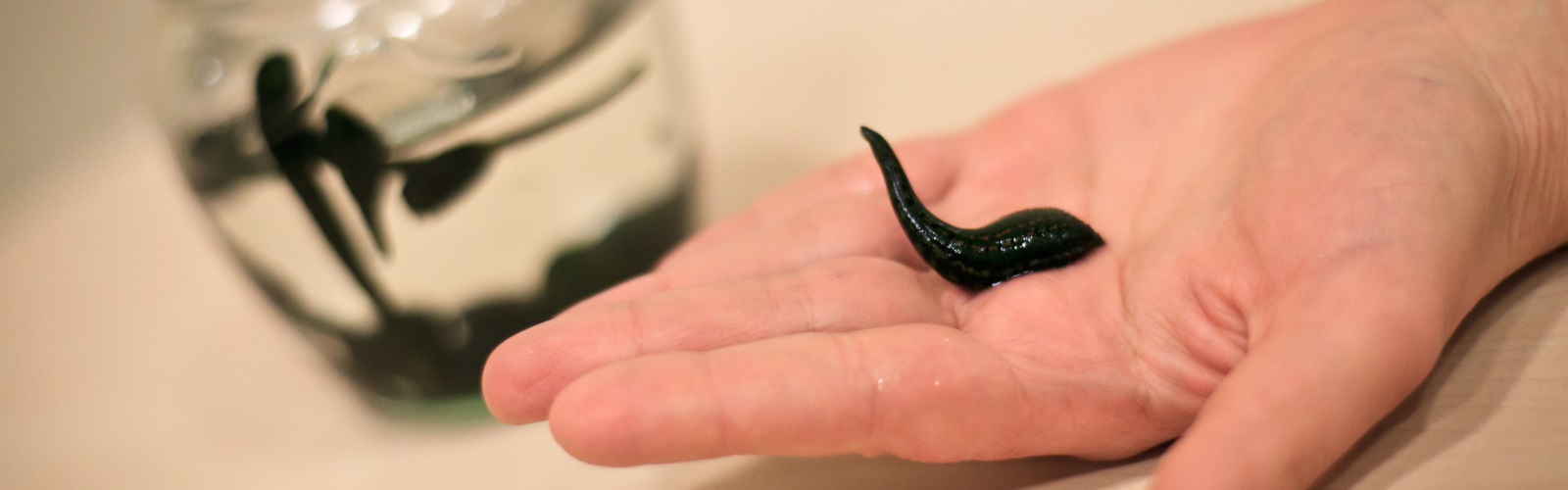 Гирудотерапия