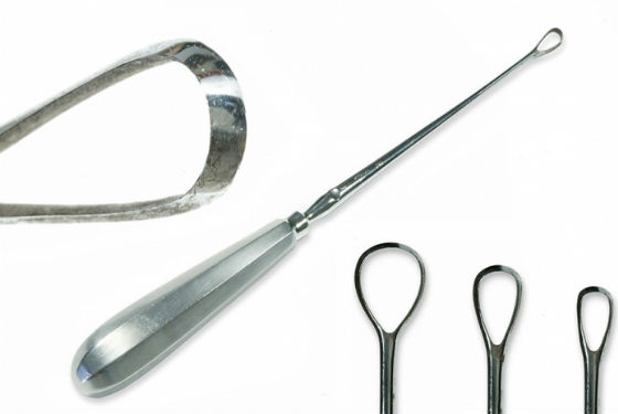 Как проводится диагностические выскабливание полости матки при гиперплазии эндометрия