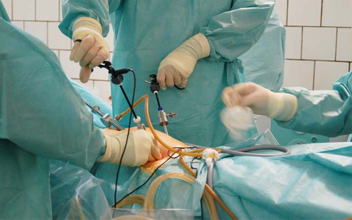 лазерноге лечение