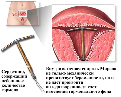 принцип действия спирали